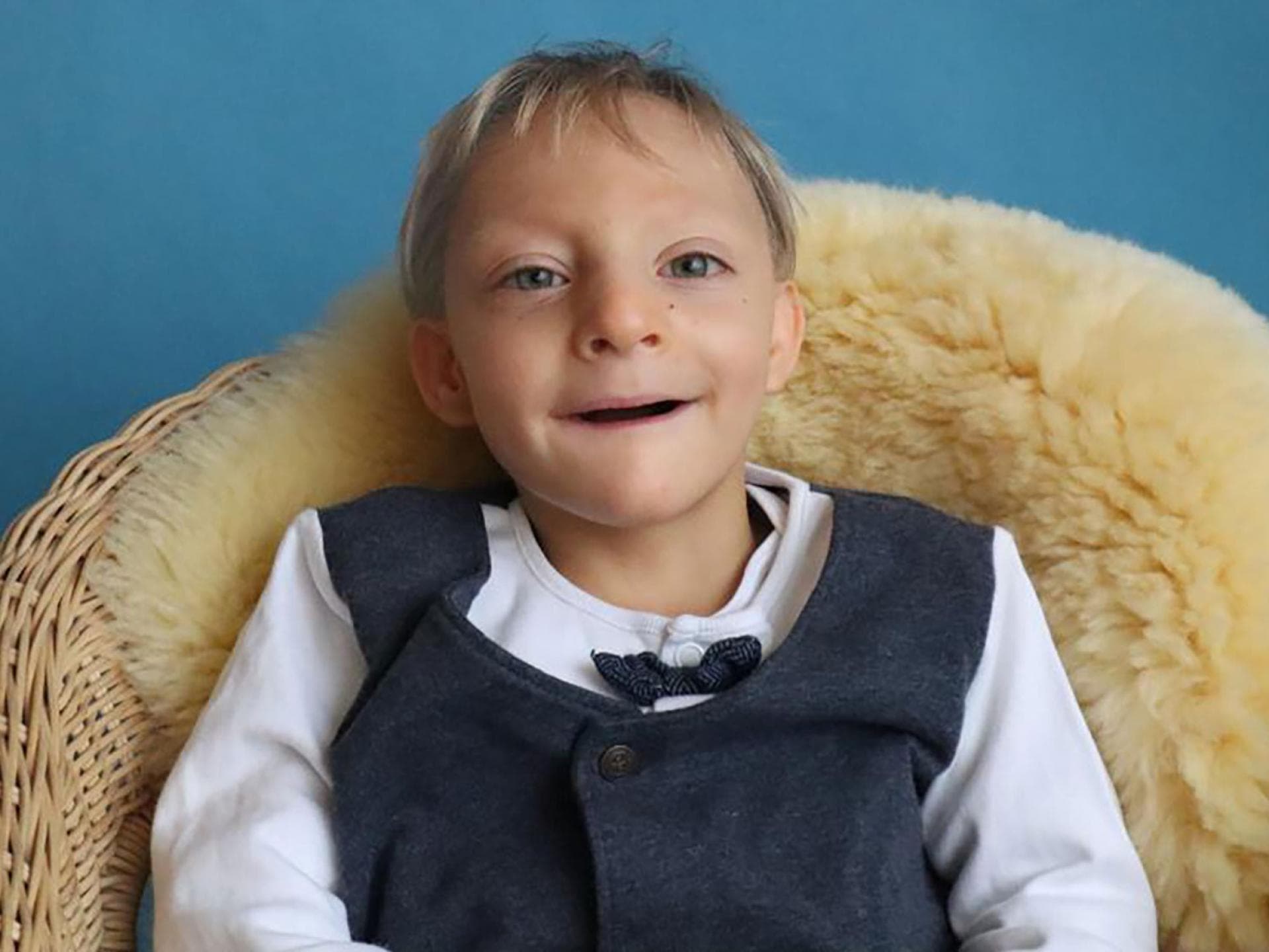 Jonathan hat den seltenen Gendefekt MOPD 1. Auf diesem Bild ist er sieben Jahre alt, aber so klein wie ein Einjähriger. Jonathan hat den seltenen Gendefekt MOPD 1. Auf diesem Bild ist er sieben Jahre alt, aber so klein wie ein Einjähriger.