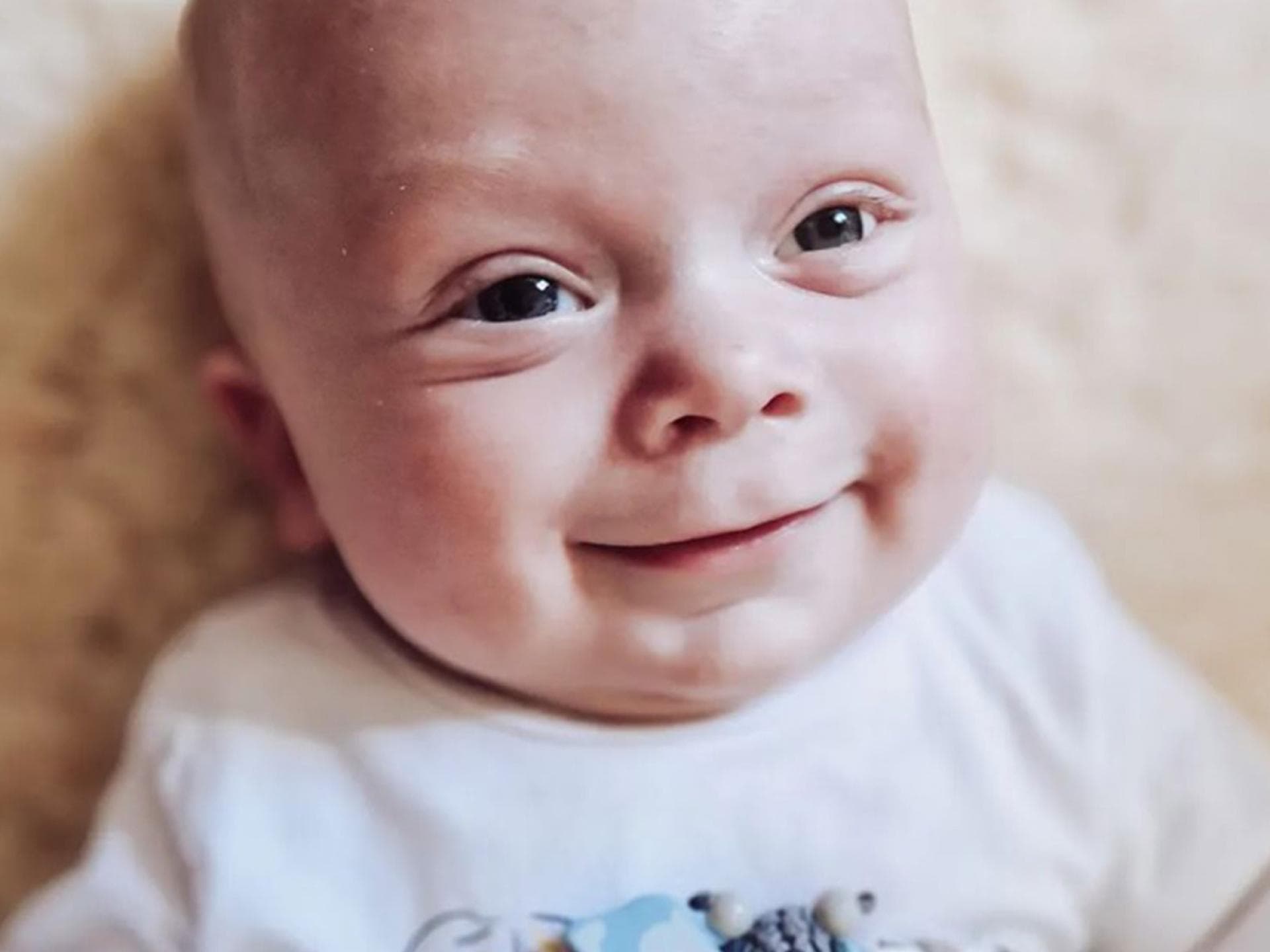 Bei der U3 wurde festgestellt, dass Arians Pupillen nicht richtig reagieren. Der Grund dafür: ein Retinoblastom in seinem Auge. Ein kleines Baby mit Glasauge.