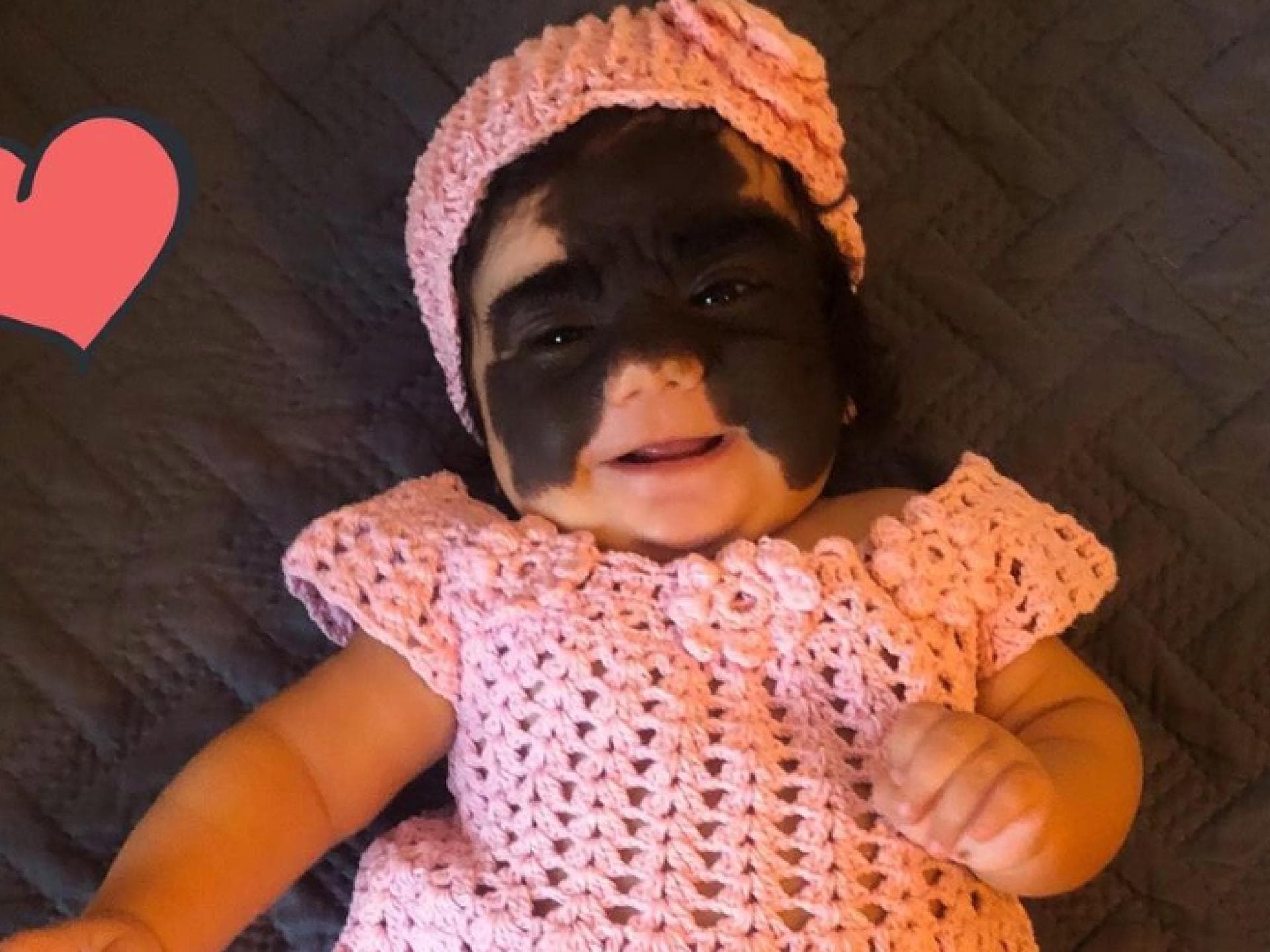 Mit diesem Bild wurde Luna Fenner, die aussieht, als würde sie eine Batman-Maske tragen, weltberühmt. 