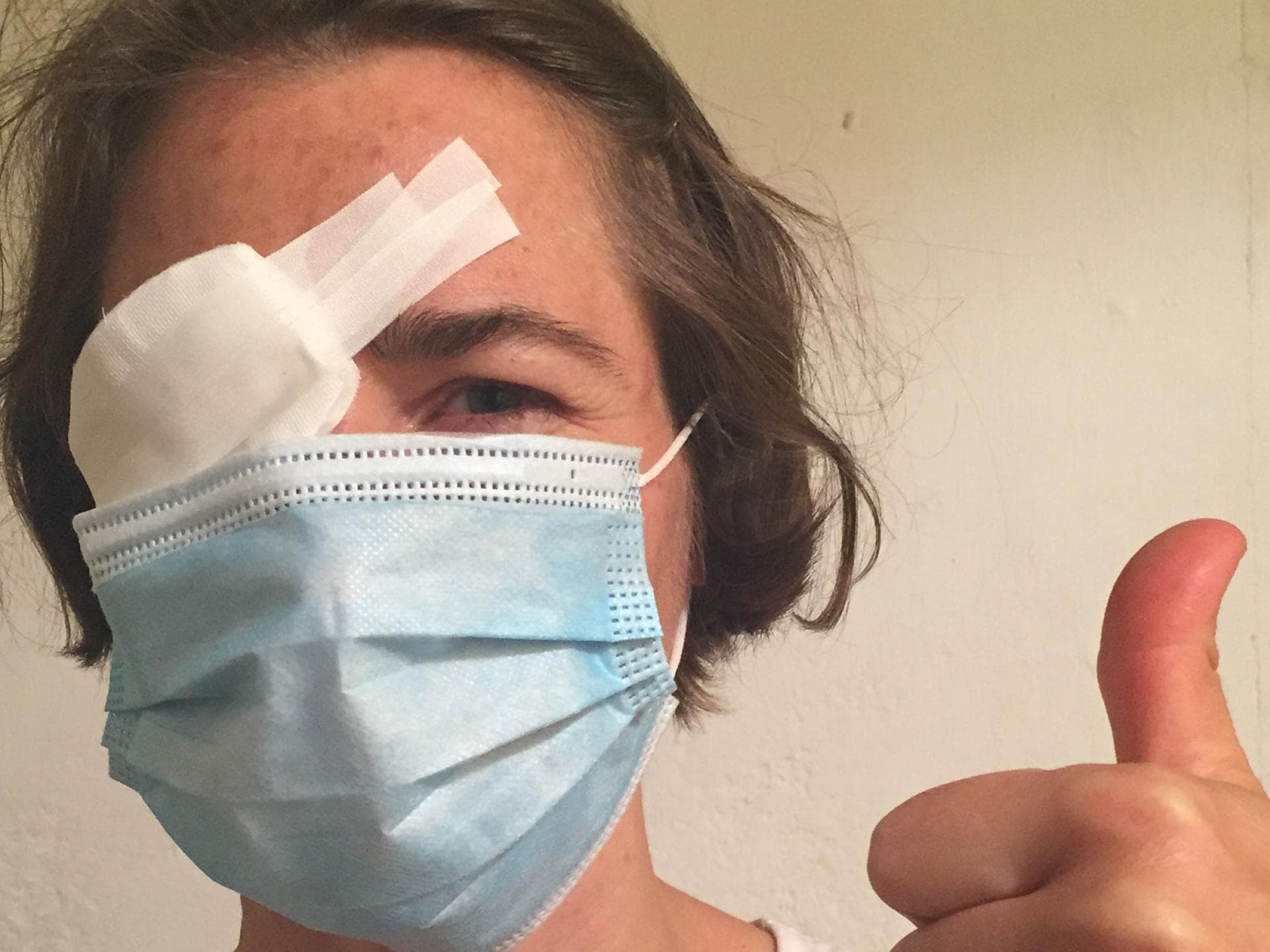 Ein kleiner Unfall ist im Alltag schnell passiert. Hier landete der Kinderfinger im Auge der Mutter.