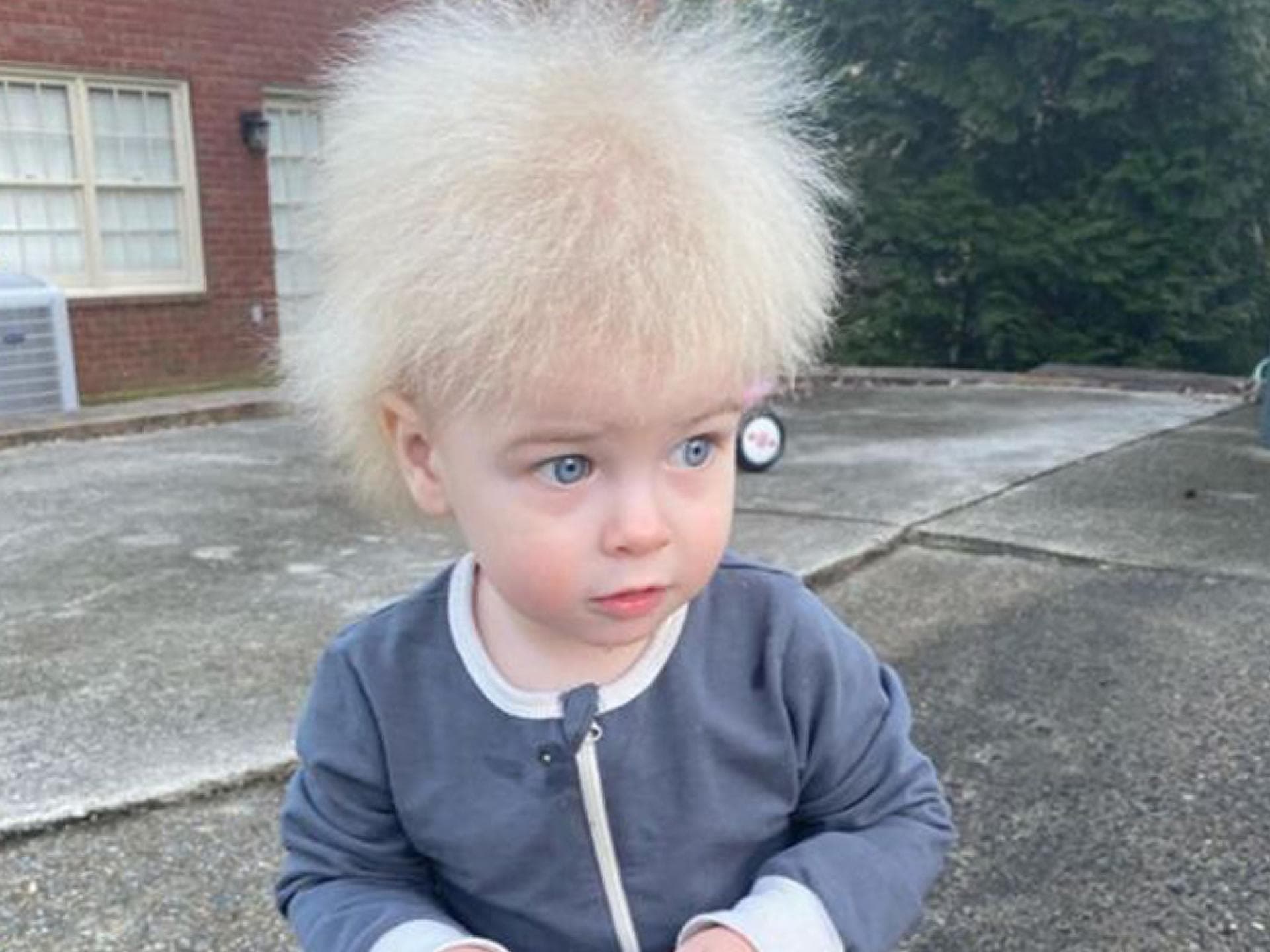 Das Struwwelpeter Syndrom bedeutet, dass dem kleinen Locklan seine blonden Haare zu Berge stehen – und zwar dauerhaft. Ein kleiner Junge mit hellem Haar, die zu Berge stehen.