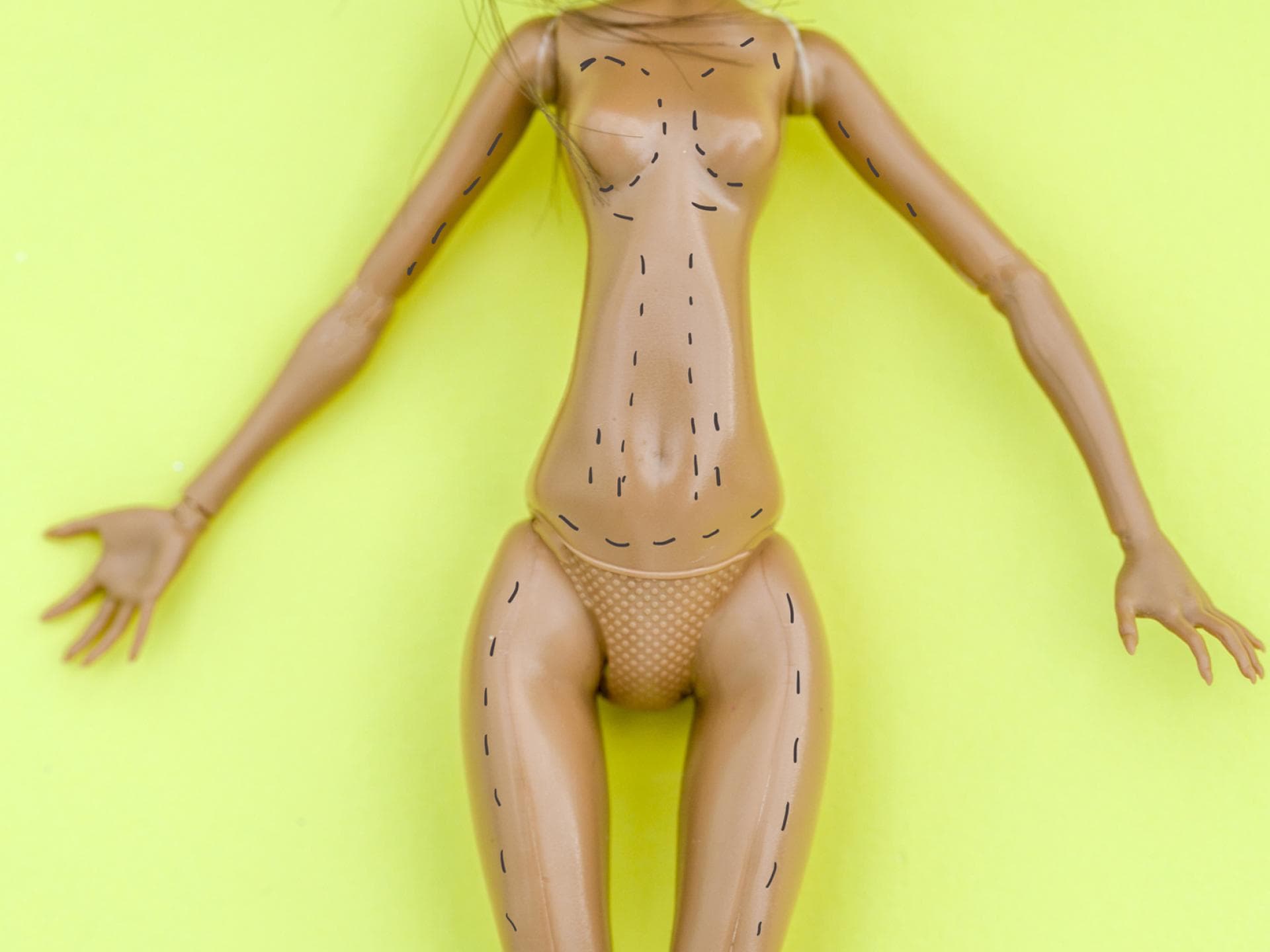 Immer mehr Frauen entscheiden sich nach der Geburt zu einem "Mommy Makeover". Immer mehr Frauen entscheiden sich nach der Geburt zu einem "Mommy Makeover".