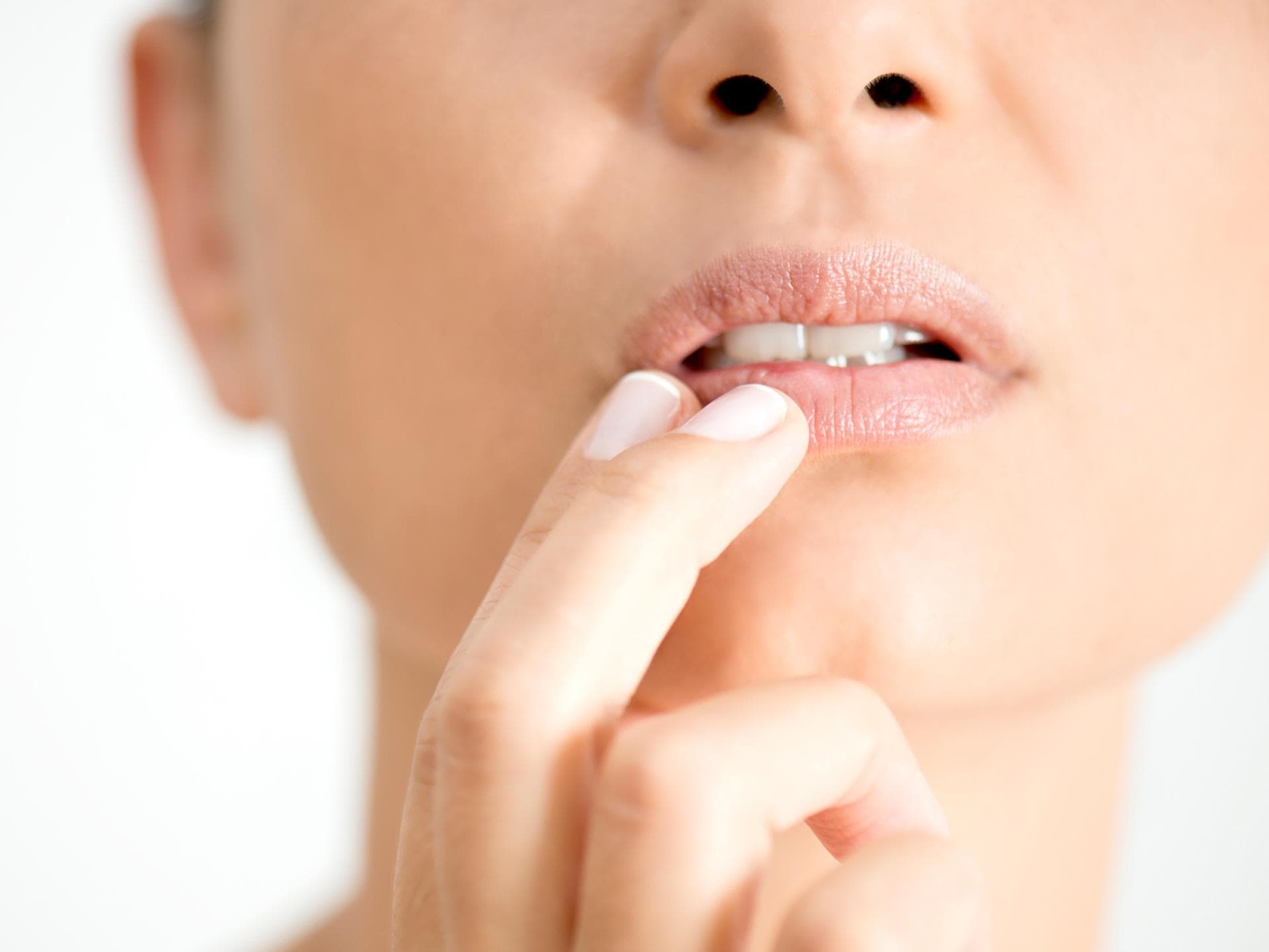 Bei Lippenherpes kommt häufig der Wirkstoff Aciclovir zum Einsatz. Auch in der Schwangerschaft darf er eingesetzt werden.