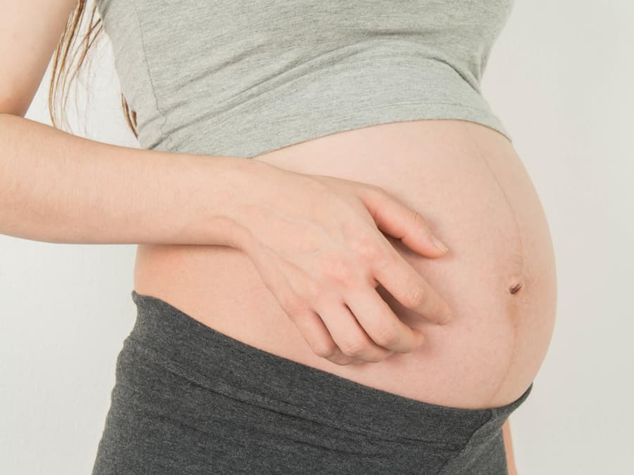 Juckreiz Am Ganzen Körper Schwangerschaft www.leben-und-erziehen.de